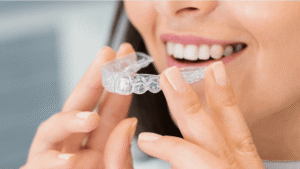 Invisalign treatment